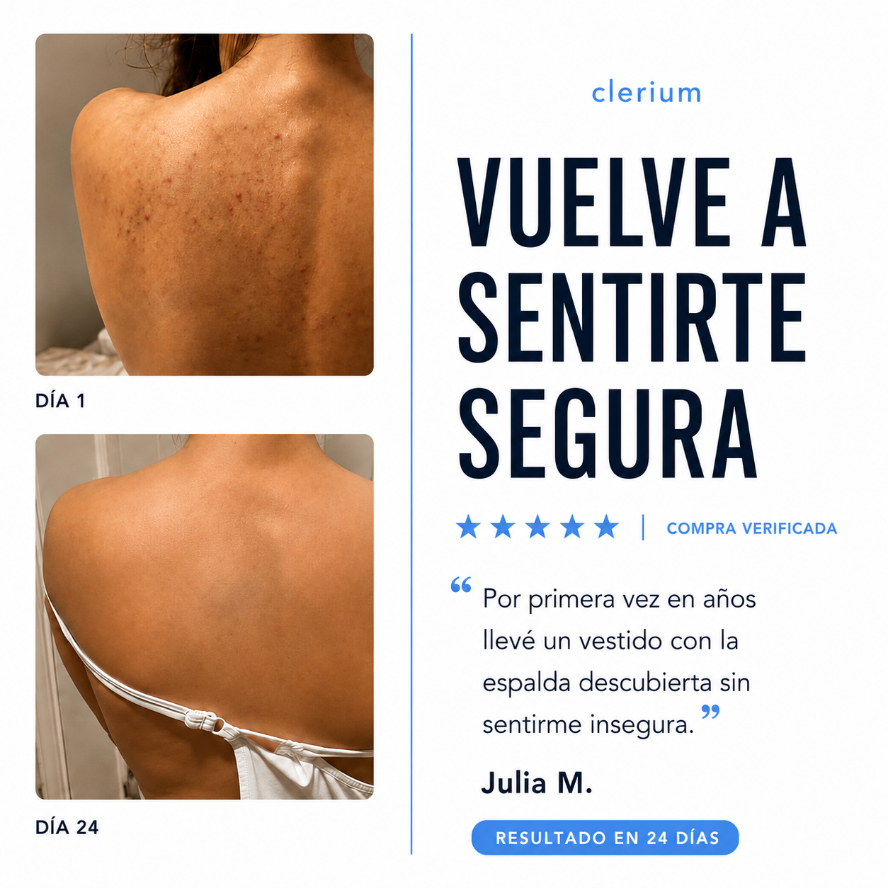 Barra Antiacné Clerium™