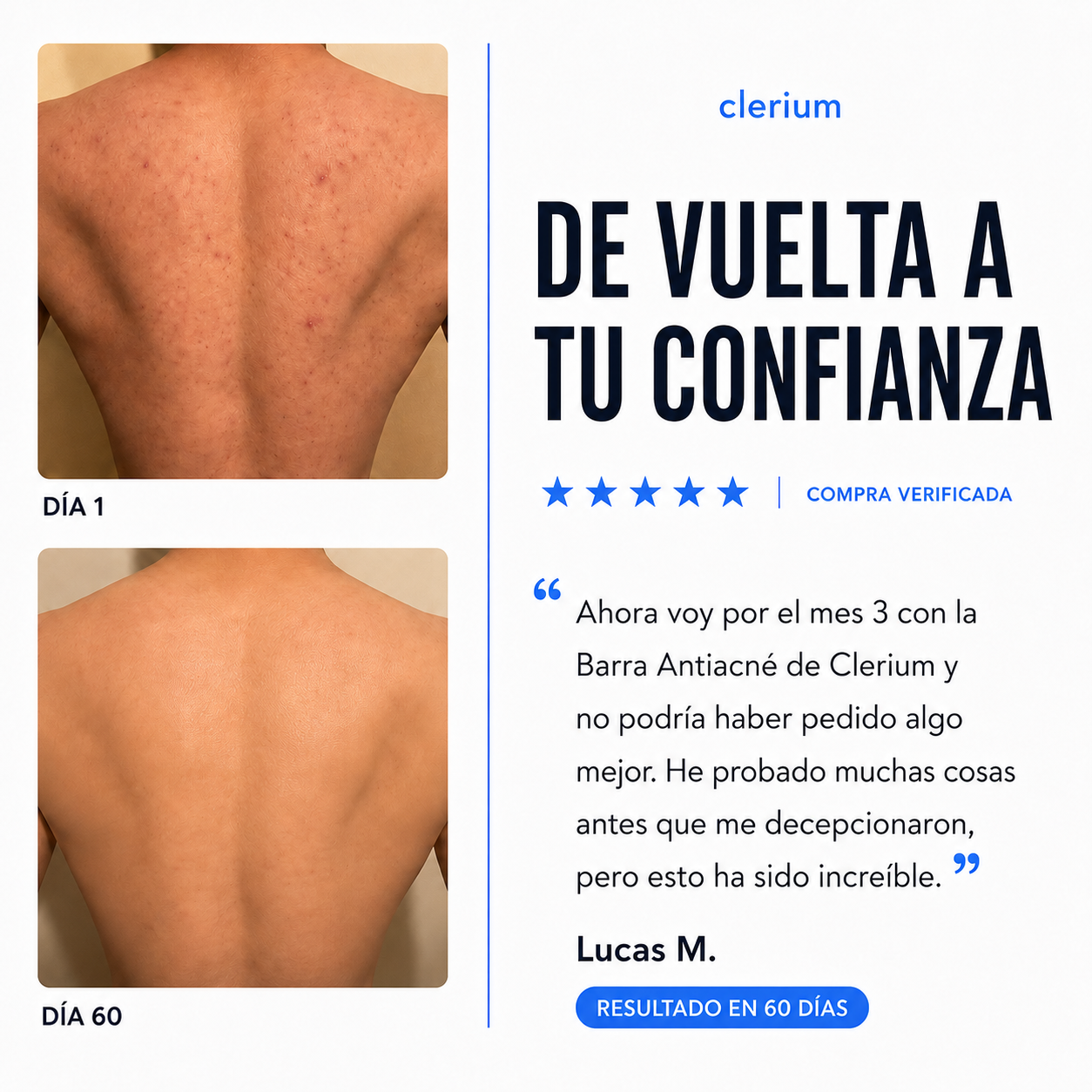 Barra Antiacné Clerium™