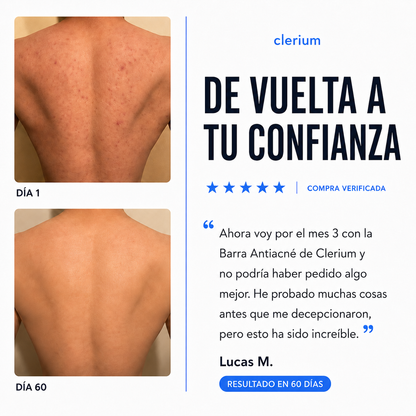 Barra Antiacné Clerium™