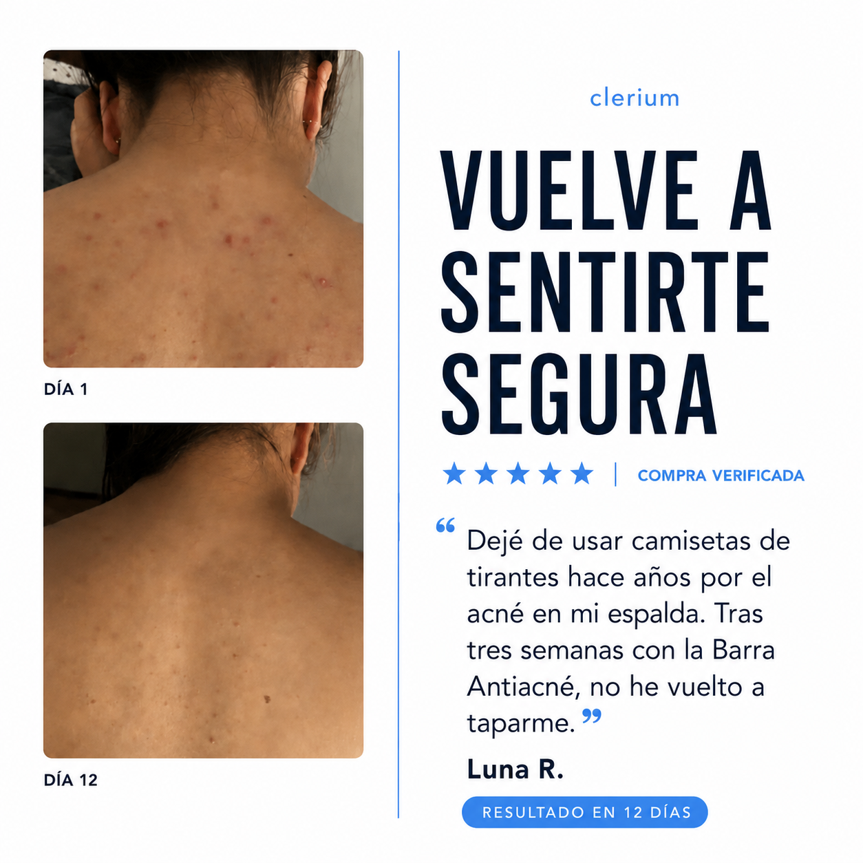 Barra Antiacné Clerium™