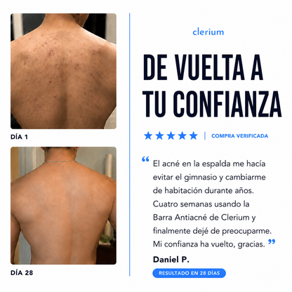 Barra Antiacné Clerium™